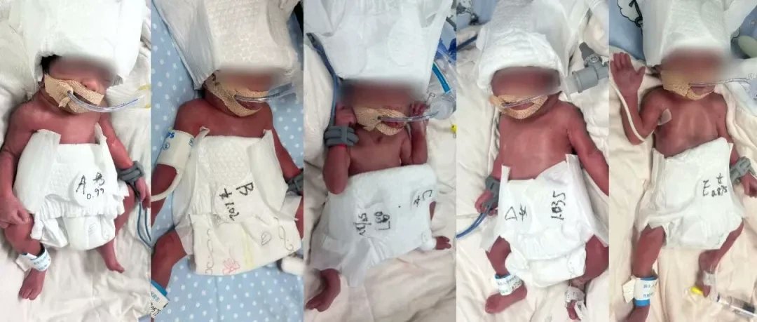 5胞胎（1男4女），今日出生！“堪称奇迹”

今日凌晨3时许，一位来自新疆的24岁产妇在湖北武汉成功分娩五胞胎，堪称生命的极致奇迹。