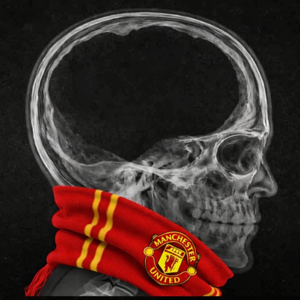 A scan of a man utd fans head ,what do you see inside?