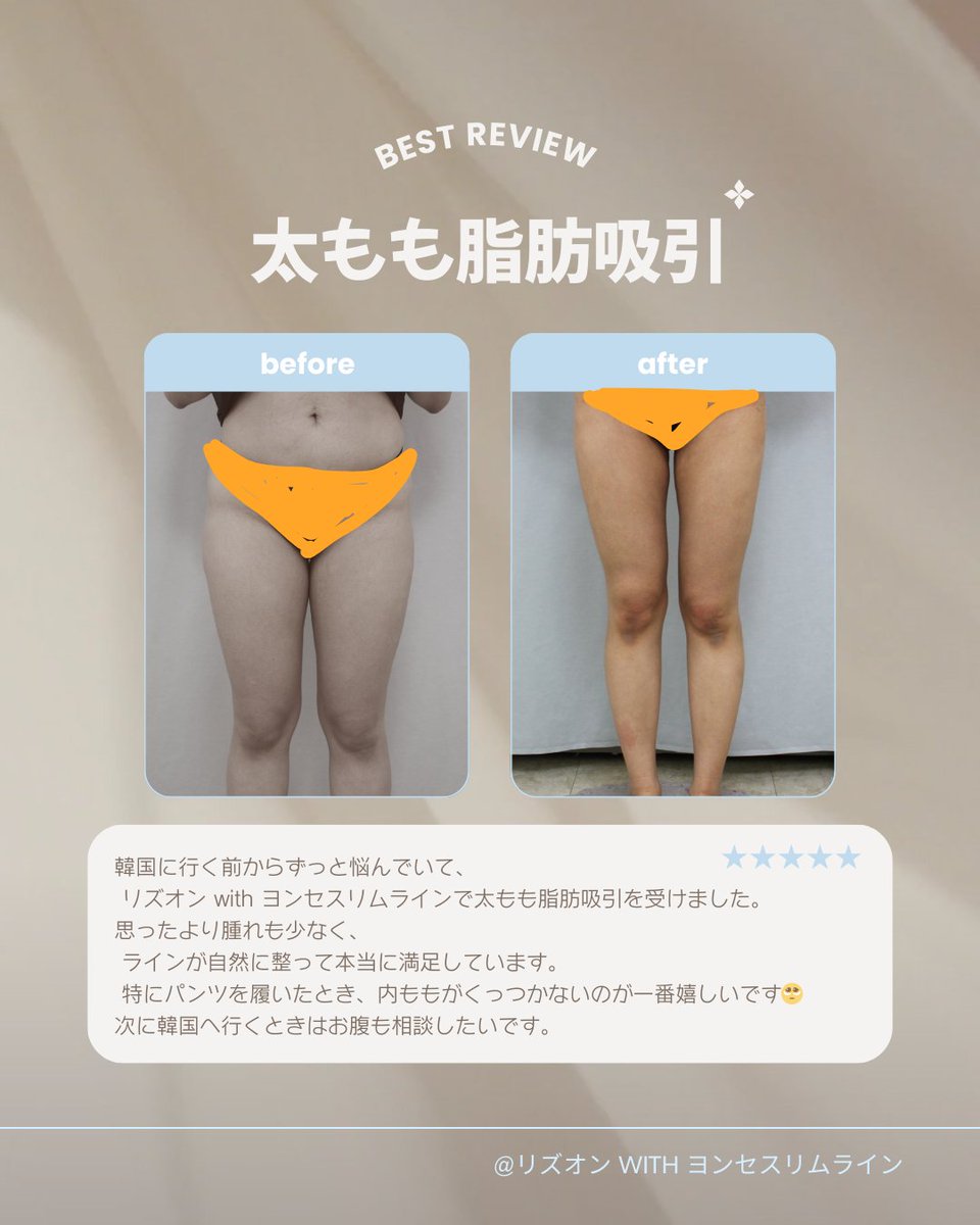 ヨンセスリムライン医院 tweet media