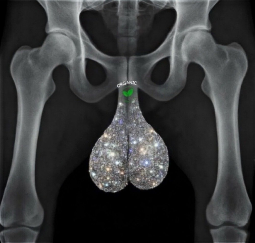 GRILLZMITH's tweet photo. Anatomy of a $GRILLZMITH holder💎

#Grillz #Solana #Solanameme #Launchtoken #memecoin https://t.co/j4AMx0In1E