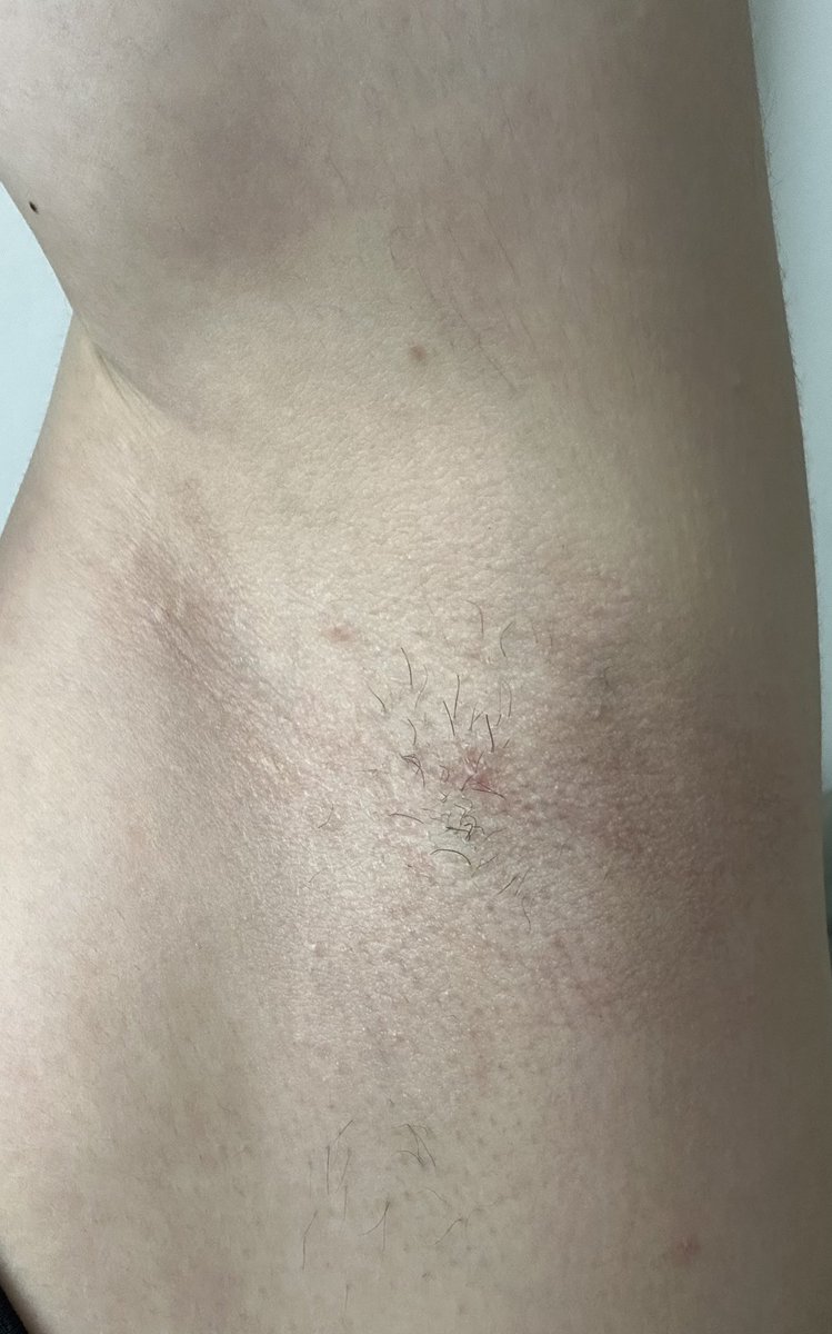 Armpits_Buttons's tweet photo. Should I ask her to grow them out?🤔 https://t.co/XGVQad2upb