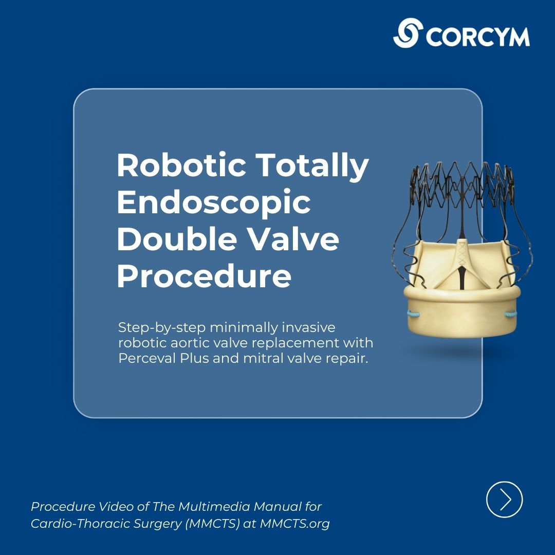 CORCYM_OFFICIAL's tweet photo. Robotic Double Valve Surgery!
🎥 Watch the full tutorial and see robotic cardiac surgery in action: https://t.co/g8YyruNR0u
#CardiacSurgery #MinimallyInvasiveSurgery #HCPsonly https://t.co/pvpWU8GcHC