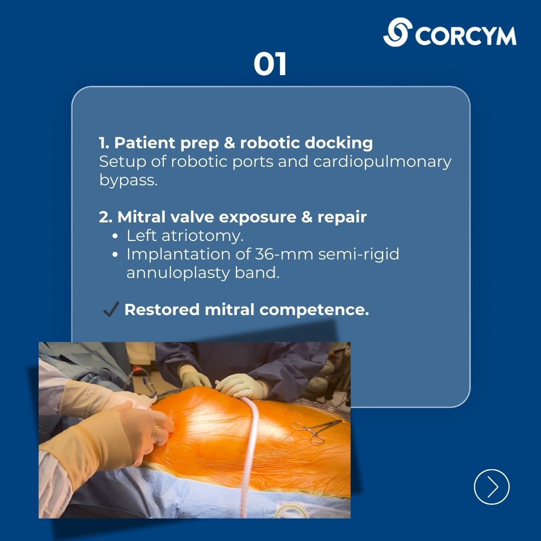 CORCYM_OFFICIAL's tweet photo. Robotic Double Valve Surgery!
🎥 Watch the full tutorial and see robotic cardiac surgery in action: https://t.co/g8YyruNR0u
#CardiacSurgery #MinimallyInvasiveSurgery #HCPsonly https://t.co/pvpWU8GcHC