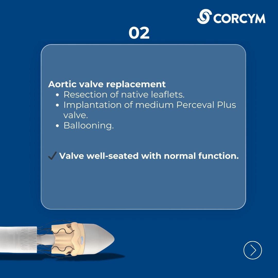 CORCYM_OFFICIAL's tweet photo. Robotic Double Valve Surgery!
🎥 Watch the full tutorial and see robotic cardiac surgery in action: https://t.co/g8YyruNR0u
#CardiacSurgery #MinimallyInvasiveSurgery #HCPsonly https://t.co/pvpWU8GcHC