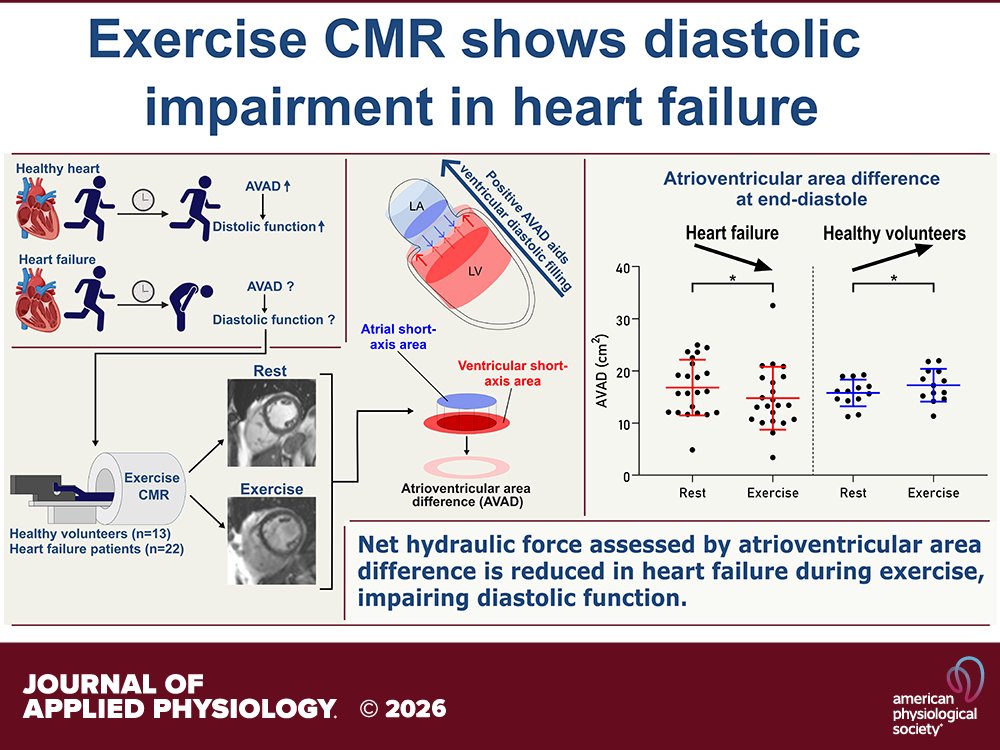 japplphysiol's tweet image. Research Article by J Edlund et al. (@kie_ehrenborg @OstensonBjorn) #Atrioventricular area difference assessed by #exercise #cardiovascular magnetic resonance shows impaired #diastolic filling in patients with #heartfailure
ow.ly/z3hb50YfmVS