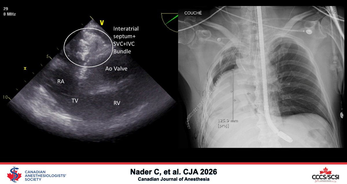 Canadian Anesthesiologists' Society tweet media