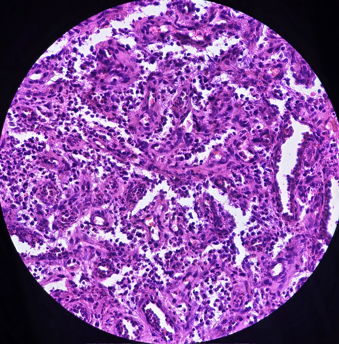 aung phyo tweet media