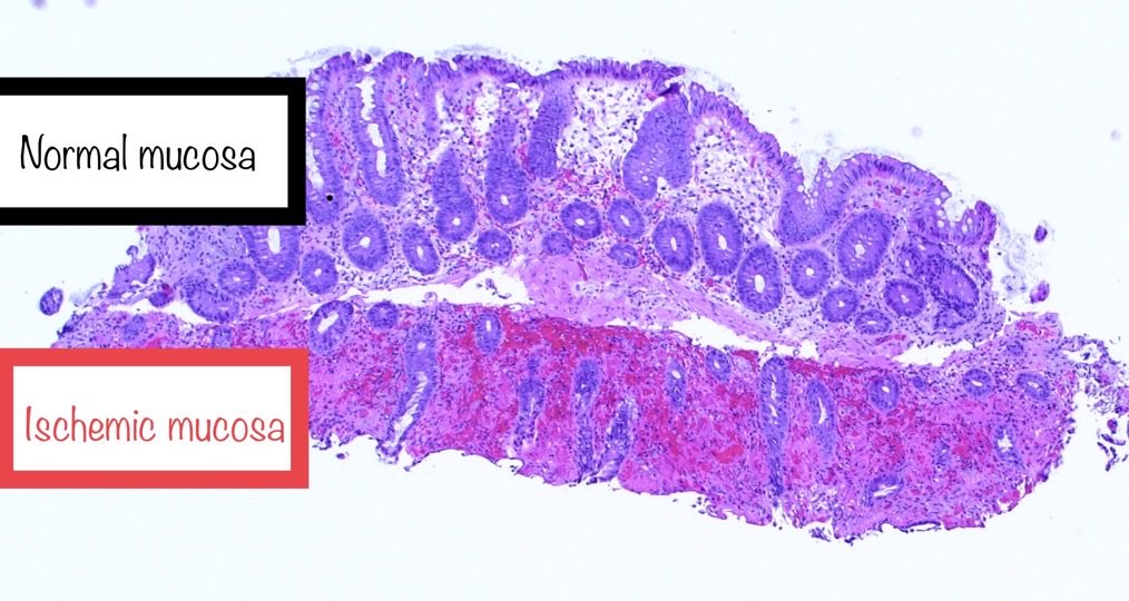 Brown Pathology and Laboratory Medicine tweet media
