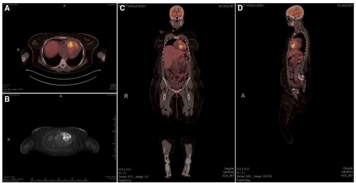 Circulation tweet media