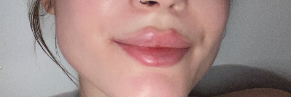 Taco Løu ◟̽◞̽ tweet media