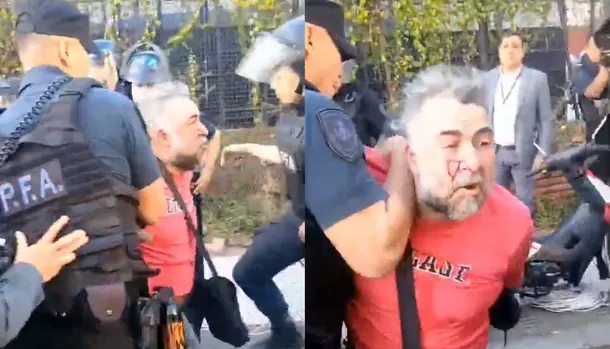 DanteForesi's tweet photo. Lo peor es que, aunque el régimen le golpéo y detuvo cobardemente a unos de sus camarógrafos, el canal A24 se le seguirá arrastrando a Milei como hasta hoy. Los integrantes de la prensa oficialista se convirtieron en mascotas dóciles, ideales para los caniles de Olivos. https://t.co/IWJz5lXENz