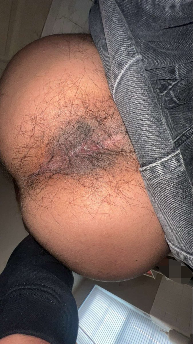bandanafag's tweet photo. Suck on my hole? https://t.co/NVQHnuiULi