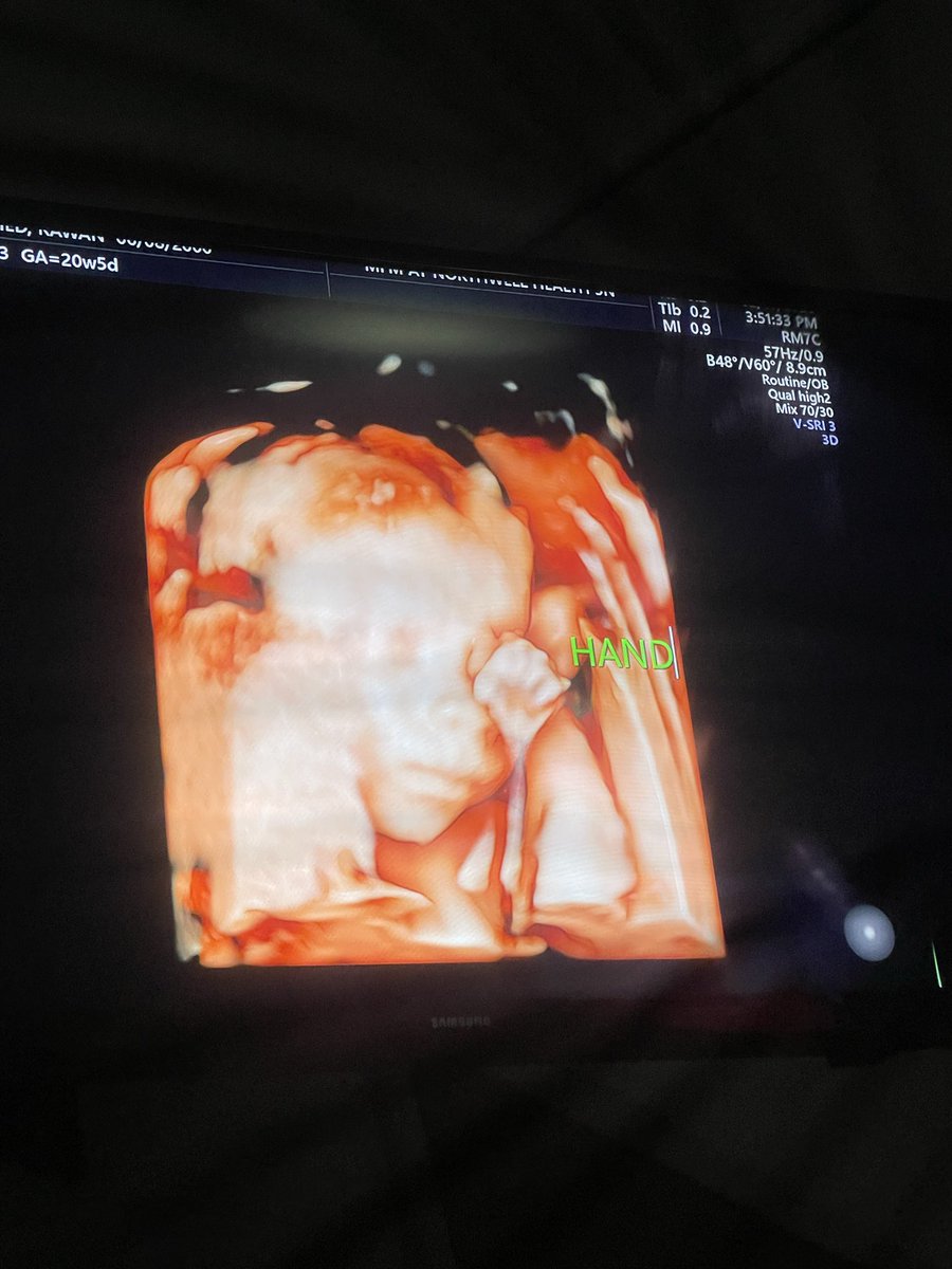 Omar Agag tweet media