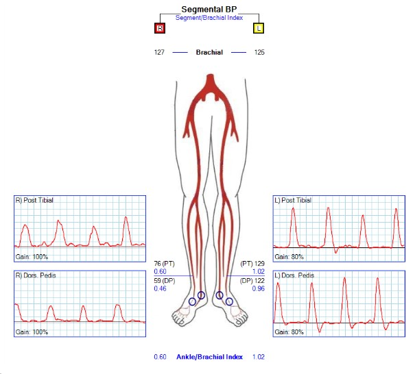 Journal of Critical Limb Ischemia tweet media