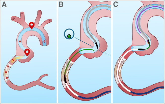 Journal of Invasive Cardiology tweet media
