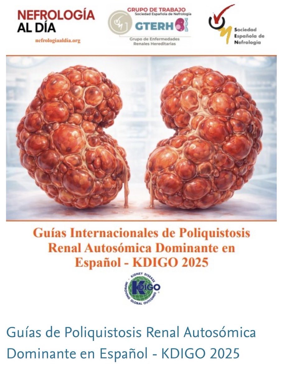 🇪🇸 Spanish #ADPKD <a href="/goKDIGO/">KDIGO</a> 👇🏻

🗣️Divulgación
ℹ️Información
📚Conocimiento 
🔹 Mejorar la calidad asistencial

🧬En las V jornadas de nefropatías #geneticas del #GTERH se ha presentado la traducción al español de las guías #KDIGO 2025 de #PQRAD 👇🏻

👩🏻‍💻🧑‍💻nefrologiaaldia.org