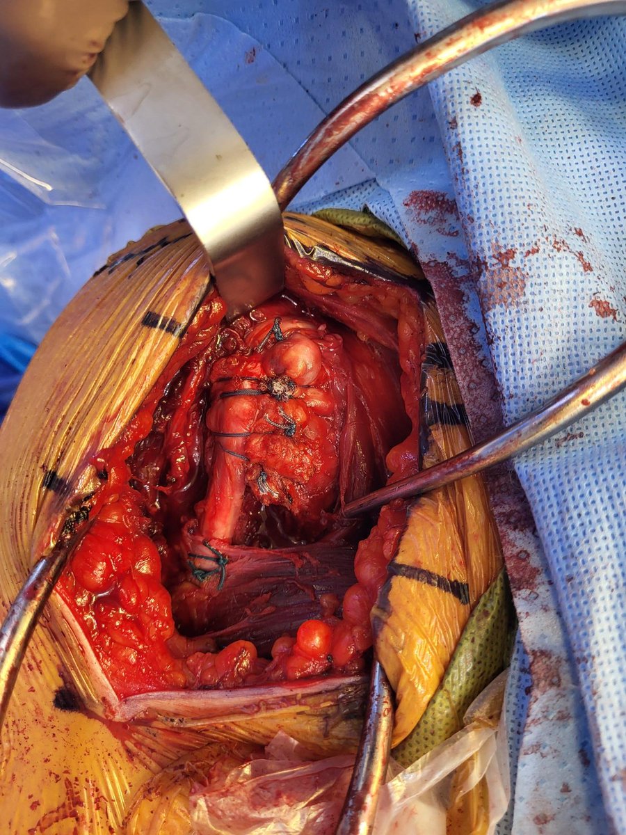 Rick Matsen tweet media