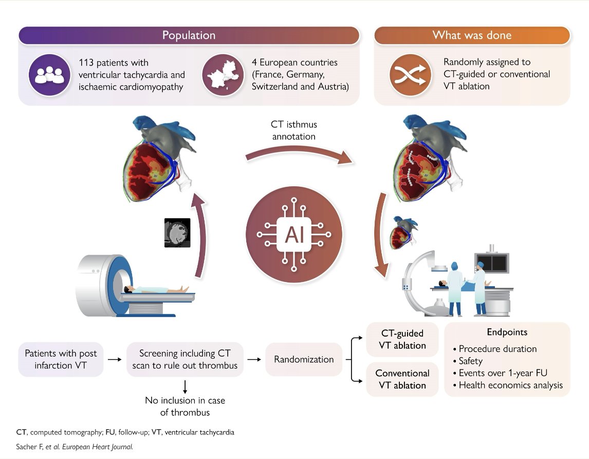 inheartmedical's tweet photo. We’re proud to share that the @ineurheart Project RCT findings presented last year at #HRS25 have now been published in full in the European Heart Journal.

Cardiac CT-based ablation strategy, processed by #inHEART, delivered impressive results—confirming the pivotal role of advanced imaging in the treatment of cardiac arrhythmias:
🔹Image integration reduced procedure time by 28% using dedicated protocol
🔹Improved the one-year VT-free survival rate to 77% (vs. 67% without image integration)
🔹Reduced procedural costs by 11%

Congratulations to Drs. Frédéric Sacher, @MaximeSermesant, Hubert Cochet & @ihu_liryc, @Inria, @CHUBordeaux, @univbordeaux and to all the partners involved in making this project a success.

Read the publication: https://t.co/G3dvRtnimx

#epeeps #cardiacimaging #VTablation #cardiacarrhythmia