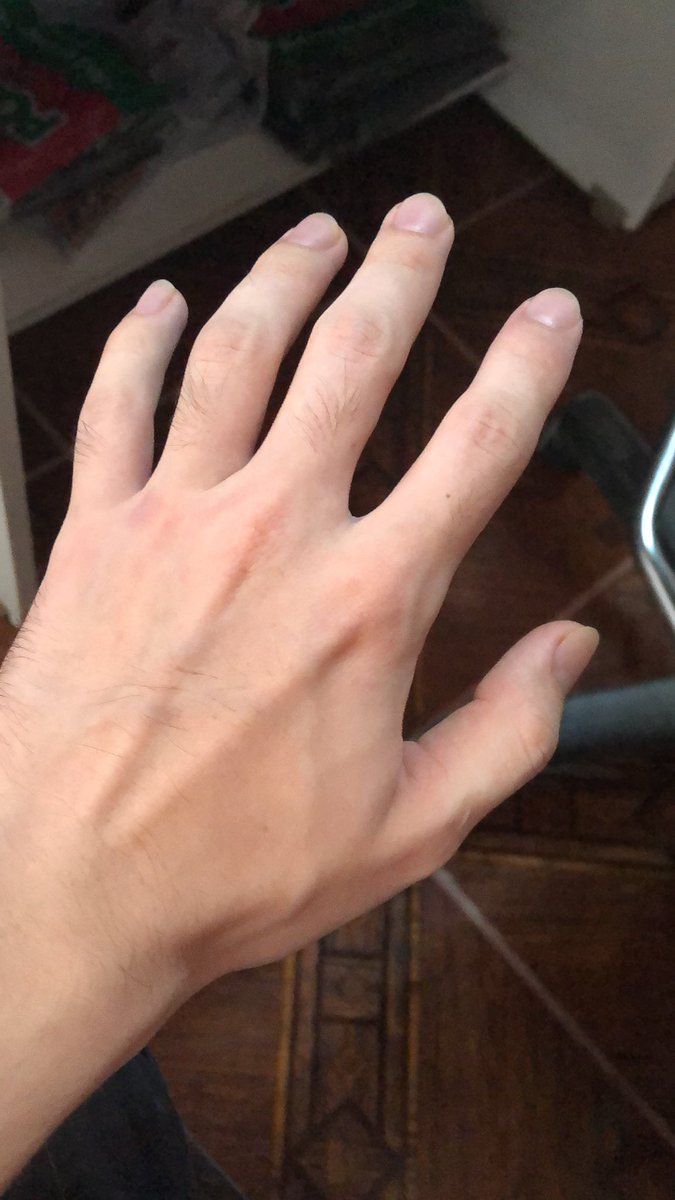 Splinter psicología tweet media