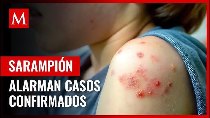 Jorge_Meade's tweet photo. Le urge a Morena la Reforma electoral, les estorban los contrapesos como en las dictaduras apoderarse de todos los espacios. 
El pueblo de México vive hechos innegables que son responsabilidad de los gobiernos de Morena, de la incapacidad, la indolencia y la complicidad de la 4T.
El sarampión después de décadas volvió a causar muertes, el no dar continuidad al sistema de vacunación a las niñas y niños tuvo consecuencias.
 Los abrazos y no balazos mostraron sus efectos, grupos armados desafian al Estado. La complicidad con ellos de Morena para tener recursos y apoyo para que ganen elecciones a sido denunciado, no pasa nada, la impunidad por encima de todo, apoderarse de todo a costa de lo que sea.