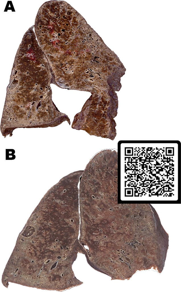 Arch Pathol Lab Med tweet media