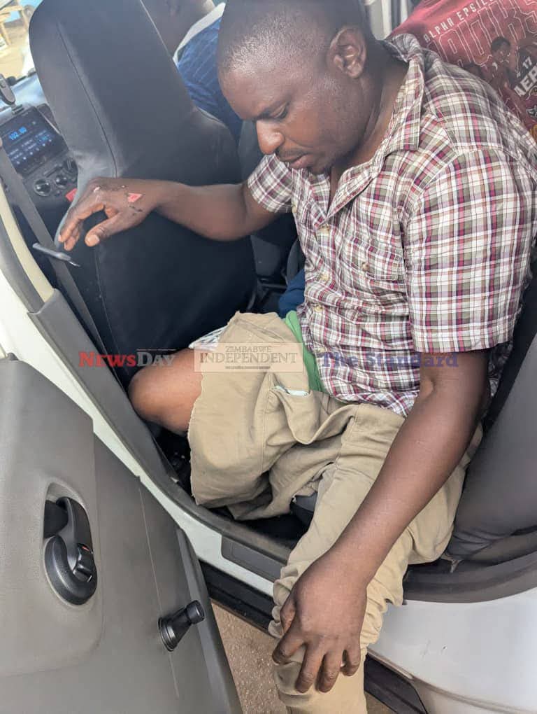 NdwgWomen35986's tweet photo. Until when are we going to ignore these barbaric acts by Zanu PF.
When are our people going to rise and say NO to this indecency and inhumane treatment. Citizens are not Criminals ‼️‼️‼️. 
#NoTo2030
#ZanuuPfMustGo
#FakaPressure https://t.co/yM8QKjeBGf