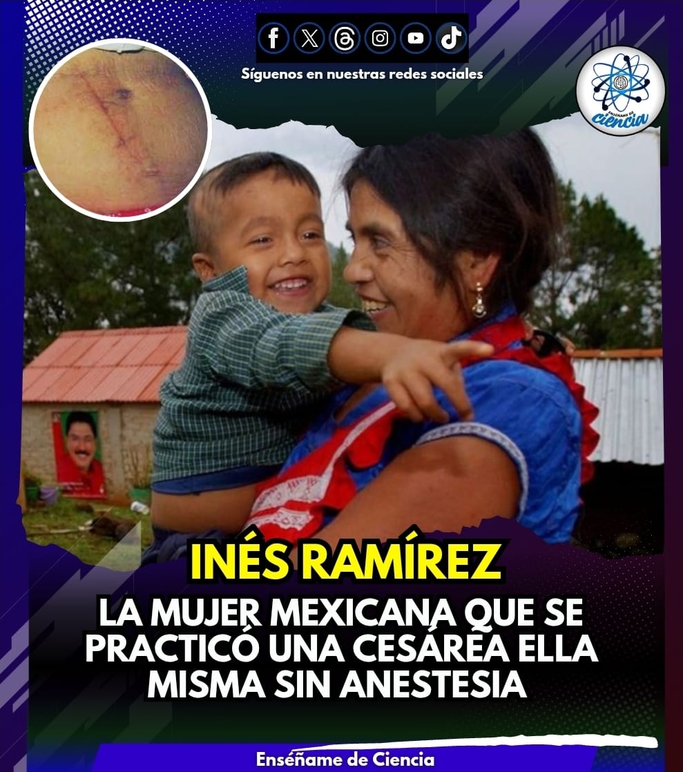 El caso viral de Inés Ramírez, una mujer mexicana que ante la emergencia y con las dificultades hospitalarias que enfrenta su comunidad, en un acto de amor y valentía, decidió practicarse una cesárea, ella misma.

Luego de operarse por su propia cuenta en un intervalo de una