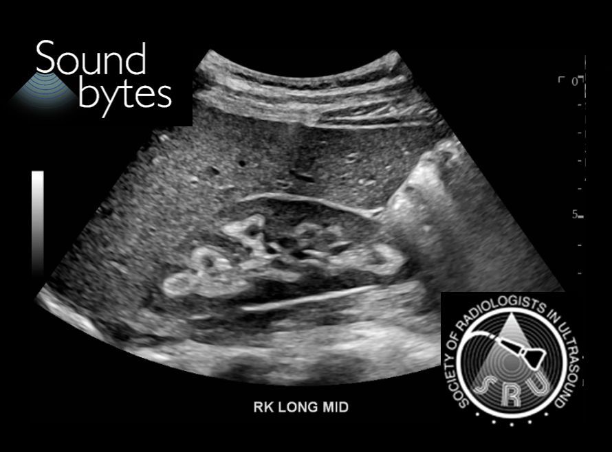 SRU Radiology tweet media