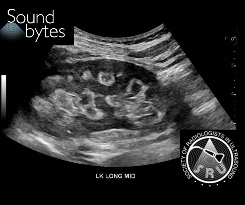 SRU Radiology tweet media