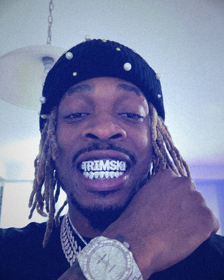 Ok I’m trimskiiiiii. You lowlife bums.