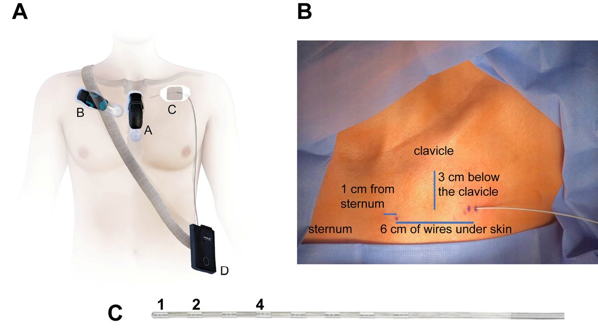 Heart Rhythm O2 tweet media