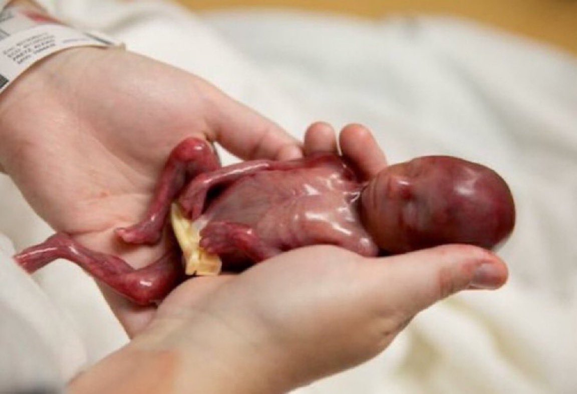 El aborto es el genocidio más cruel de la historia.

Lo proteja una constitución o quien sea.

Y vosotros sois los embajadores del demonio en la tierra.

Ayer era Herodes, hoy son, entre otros, el gobierno de España.