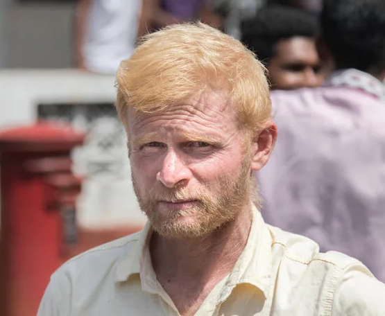 sidthisside's tweet photo. Indians with albinism could walk through Stockholm unbothered and that completely broke my brain https://t.co/dCBwfn8yXS