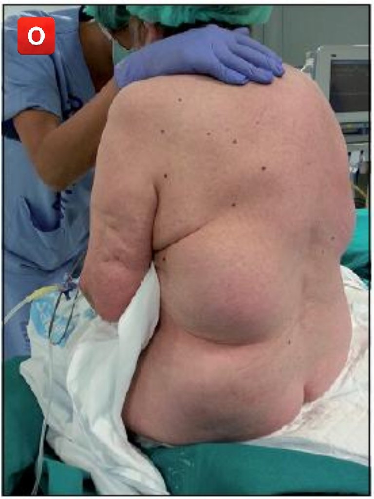 DoctorDatos's tweet photo. @IhabFathiSulima 🅾️Diagnosis? https://t.co/AKwbCAOjhJ