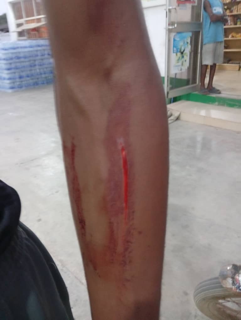 Febsbaby_'s tweet photo. Viewers' discretion advised!!
See what she did to this boy!!

As the story goes, all he did was tell her child to go inside cos the child played outside for too long!!

Next thing, she starts attacking him, saying why is he talking to her child anyhow? 
@PoliceNG @Lagosdsva https://t.co/E94g41p97R