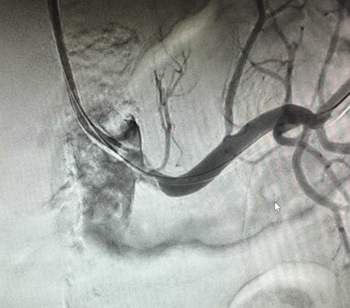 Robert A Lookstein MD, MHCDL tweet media