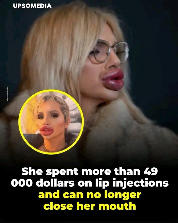 Spent 49 000$ for this 🤤. Sorry