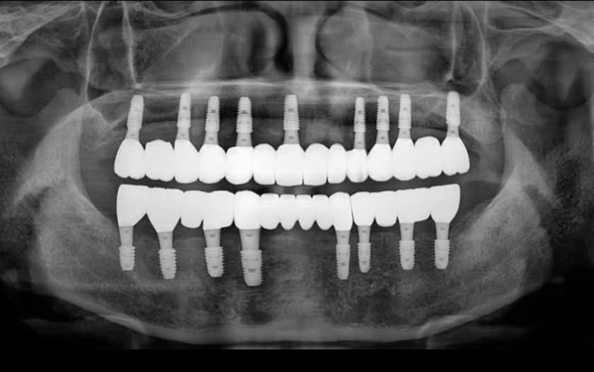 وليد صادق tweet media