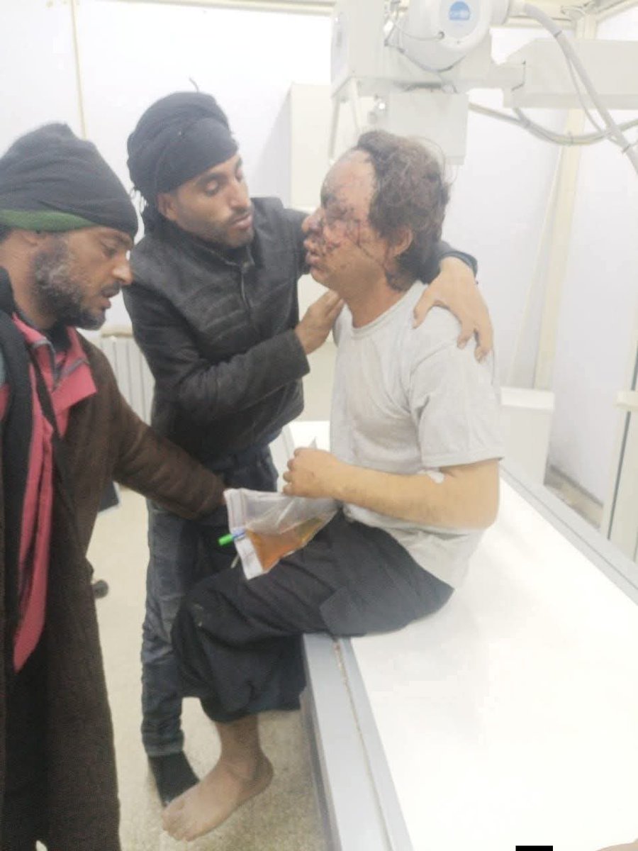 المصائب في هذه البقعة لا تتوقف، ومن يدفع ثمنها فقراء الغالبية المنسية. الله يتولاه برحمته.