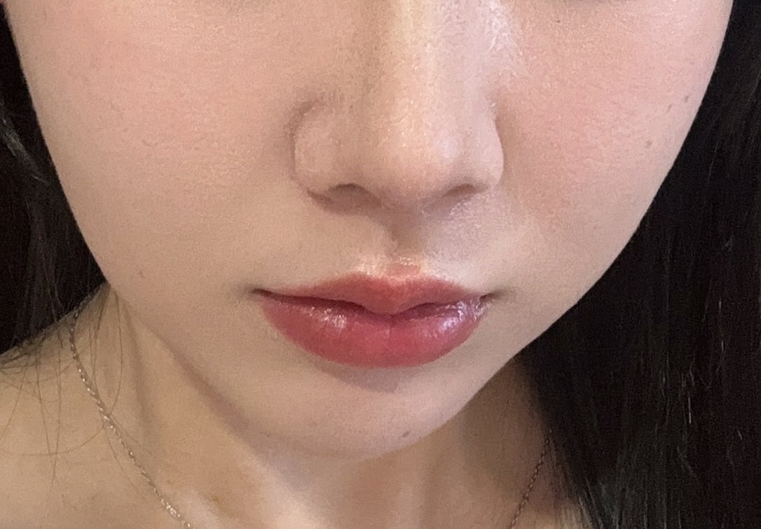 ７@鼻整形DT tweet media