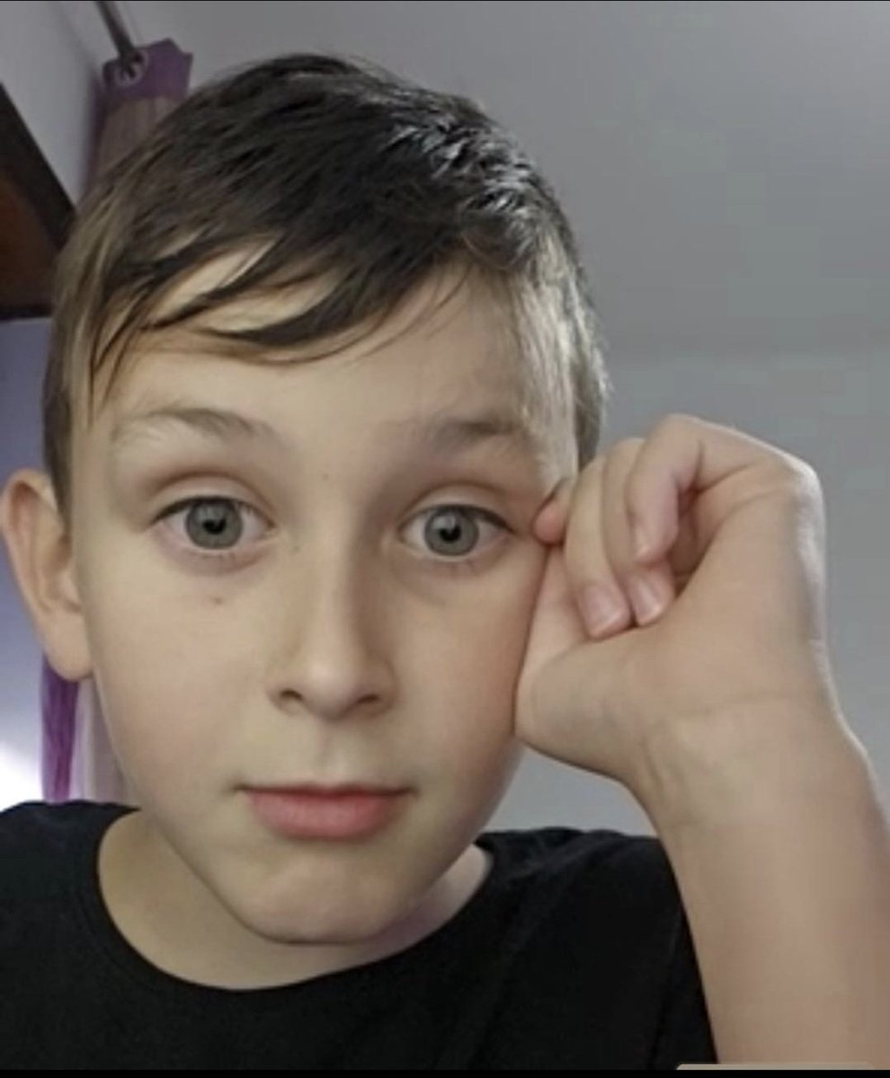Paulito_GT's tweet photo. O hugo arriscou e pagou para ter os olhos parecidos aos do meu filho. 🤣🤣 
#sstvi https://t.co/gybJZeEUvl
