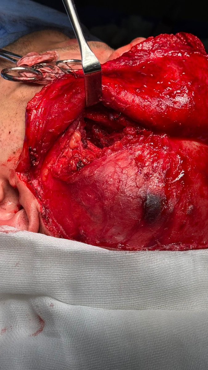 Hugovical tweet media