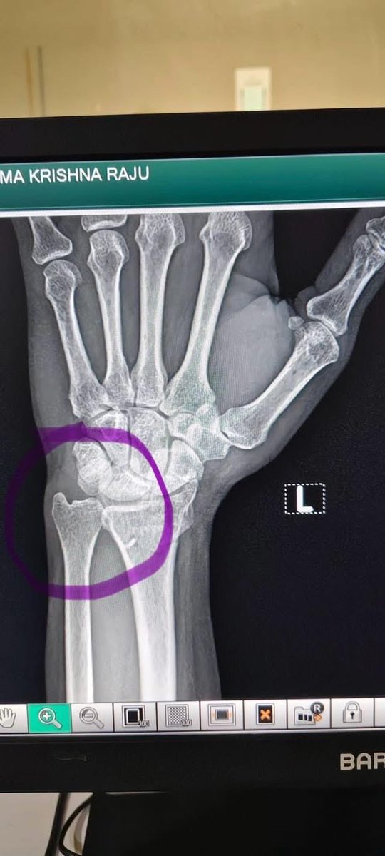 PV Sunil Kumar tweet media