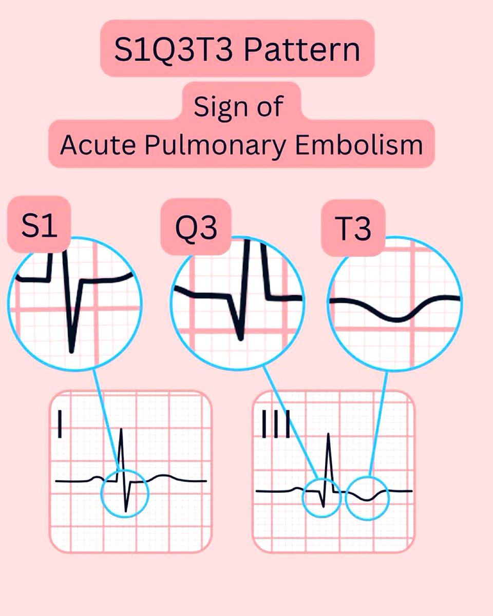 ُTHE GOAT tweet media