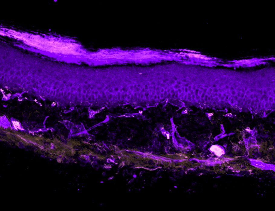 ScienceMagazine's tweet photo. A new @SciImmunology study suggests that IL-10-producing monocytes help resolve pain faster in male mice and humans when compared with females, which could inform therapeutics for sex-specific pain conditions. https://t.co/rA0erb83uS https://t.co/QQ5eD0EAUG