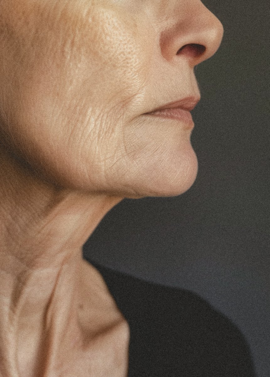 SKYN®Subiaco tweet media