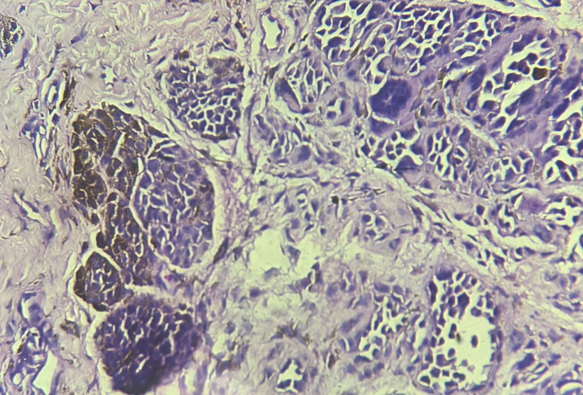 aung phyo tweet media