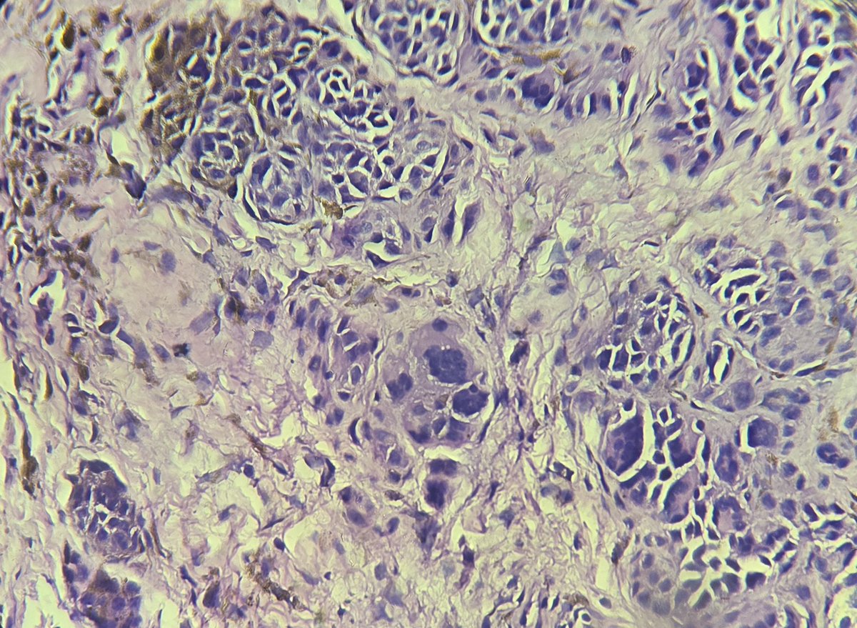 aung phyo tweet media