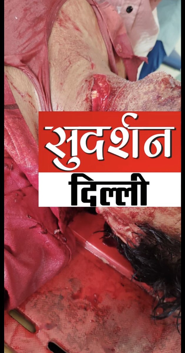 Ex मुस्लिम सलीम जी के लिए प्रार्थना कीजिए।

कट्टरपंथियों ने बेदर्दी से गला काटा है।