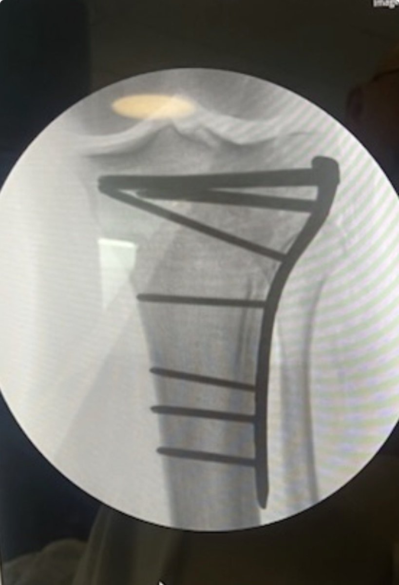 Steffen Larsen tweet media